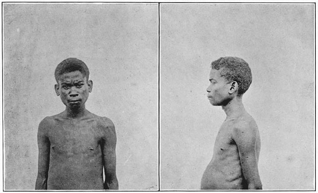 Negrito man of Negros (mixed blood).