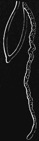 Fig. 114. Medusa with a simple thread-like tentacle.