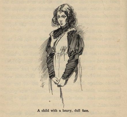 A child with a heavy, dull face.