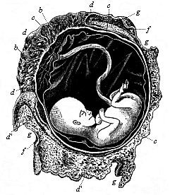 Fig.199. Human foetus, twelve weeks
old, with its membranes.