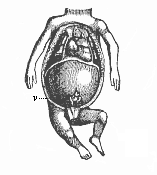 Fig.357. Thoracic and
abdominal viscera of a human embryo of twelve weeks.